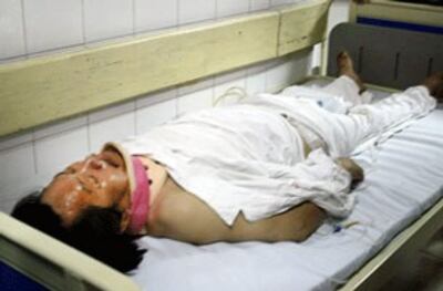 Bị trung tá công an Nguyễn Văn Ninh đánh gẫy 2 đốt sương cột sống vùng cổ ông Trịnh Xuân Tùng đã mất sau gần bảy ngày cầm cự . Source dantri.com