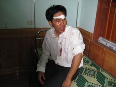 Linh mục Ngô Thế Bính bị một số người lạ mặt đánh vỡ đầu.